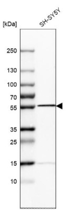 Septin-6 Antibody, Novus Biologicals 0.1mL; Unlabeled:Antibodies, Polyclonal